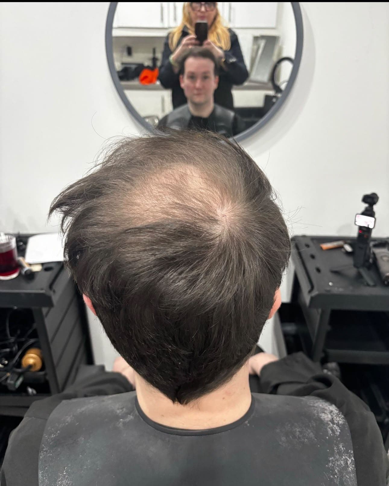 Before: client's thinning hair, front view