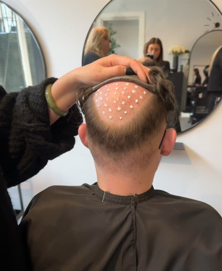 Man wearing a hair system fitted at Kroma, Glasgow, front view